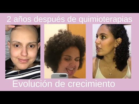 Vídeo: Mi Diario De Quimioterapia: 52 Fotos De Pérdida Y Recuperación Del Cabello