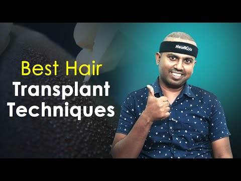 Best Hair Transplant Techniques: How to Choose the Right One? 🤔 | New Roots