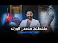 طقطقة مفصل الورك Snapping Hip 