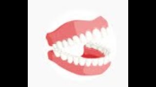 DAY 3 POST OP FULL MOUTH EXTRACTIONS + IMMEDIATE DENTURES