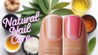 How to Get Rid of Nail Fungus Naturally