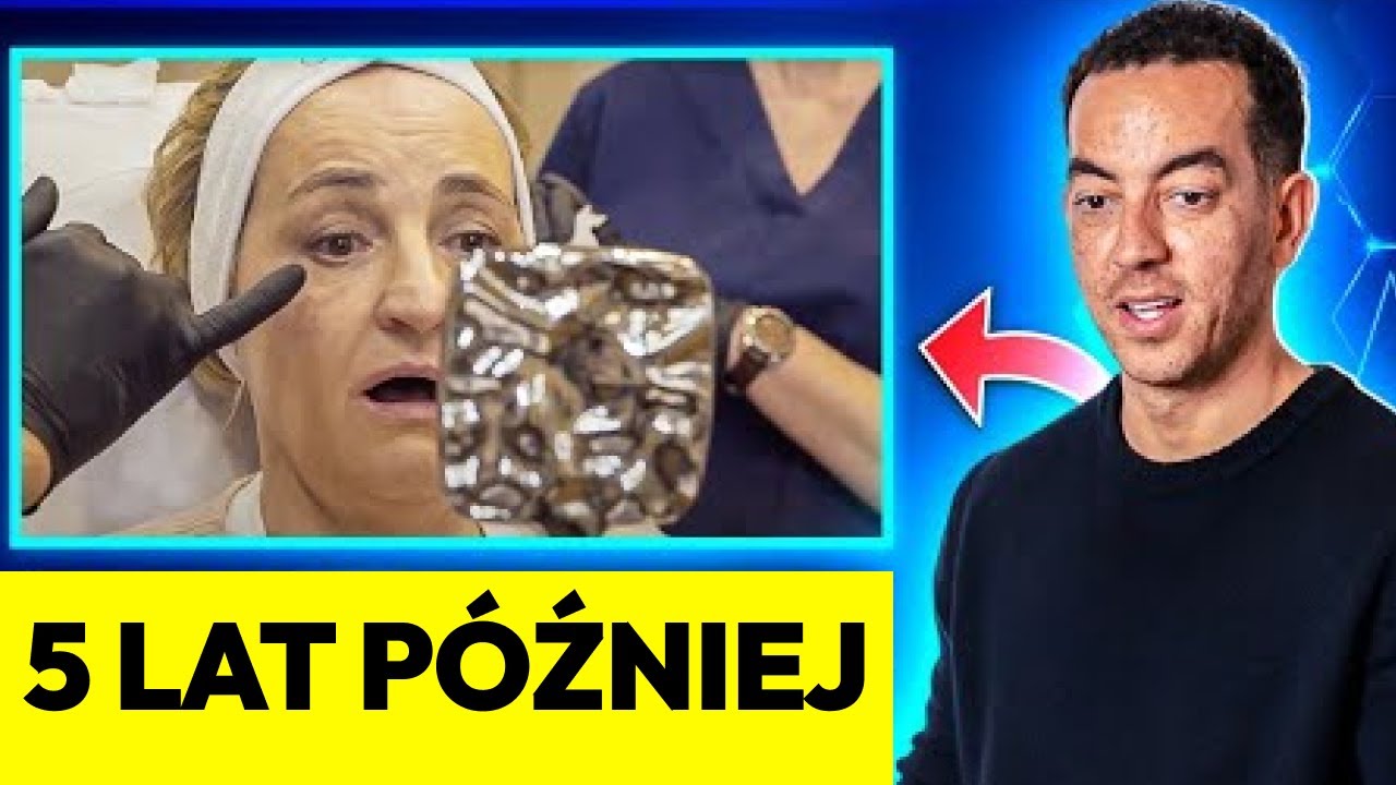 Wypełniacz Doliny Łez: Jak Wygląda po 5 Latach?