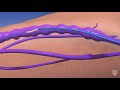 Guiding light an animated journey through endovenous thermal ablation