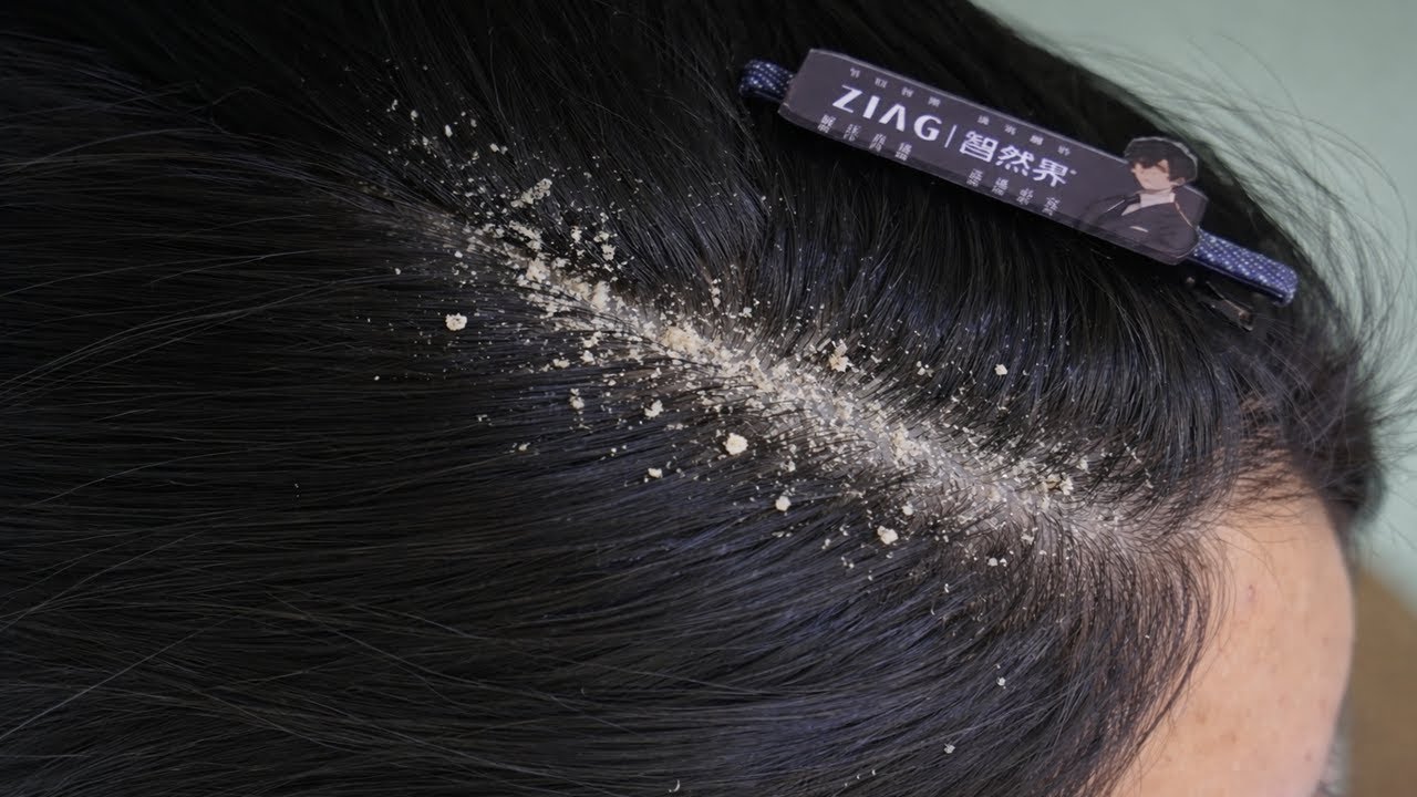 Calming Hair Scalp ASMR | Slow and Relaxing Cleaning Therapy