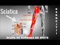 EXERCITII PENTRU SCIATICA, SINDROM DE PIRIFORM (DURERI DE SPATE)