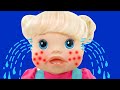 So Itchy Song | Nursery Rhymes and Kids Songs