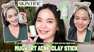 REVIEW MUGWORT ACNE CLAY STICK SKINTIFIC! Cocok utk kulit berjerawat dan pori pori besar ✨