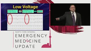 Killer ECGs