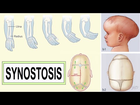 تصویری: ایلودنس به چه معناست؟