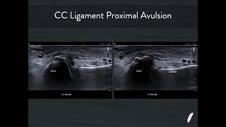 Current Concepts In Msk Ultrasound