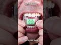 Satisfying Chewing ASMR #Compilation #ASMR #DoctorTristanPeh