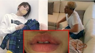 Hari Won up ảnh môi sưng,nhiều fan vào hỏi han,riêng Trấn Thành lại phũ phàng
