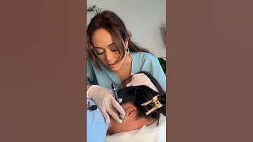 Satisfying Perfectionist Scalp Check using Interesting Tools 🤤 #asmr #asmrscalpcheck #asmrsatisfyin