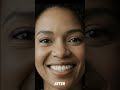 Your smile deserves care too 🦷