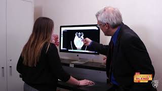 Stroke awareness with Mayo Clinic