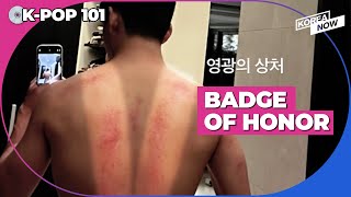 Let's find out why V has red marks on his back