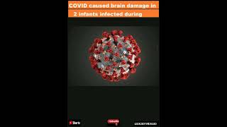 COVID caused brain damage in 2 infants infected during pregnancy -US study|#shorts