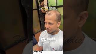 Natural-Looking Hair Patch Transformation | Hair Life India
