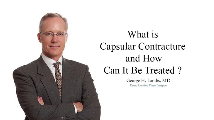 What is Breast Implant Capsular Contracture, Dr. G...