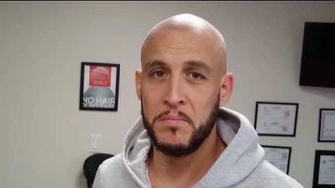 Immediately after completed SMP treatment at Scalp Aesthetics Coral Springs