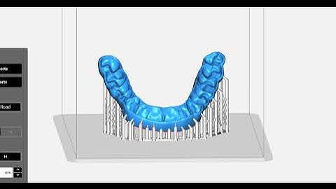 Preparing Night Guards for Print with Keysplint Soft