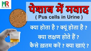 Pus Cells in urine in hindi  | पस सेल्स क्या होता है?  |  पस सेल्स की नॉर्मल रेंज क्या होती हैं ?