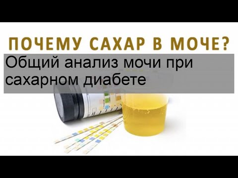 Общий анализ мочи при сахарном диабете