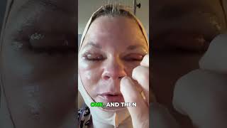 Unexpected Pain: My Post-Surgery Ear & Throat Woes