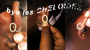 Comment soigner une Cheloide oreille ?