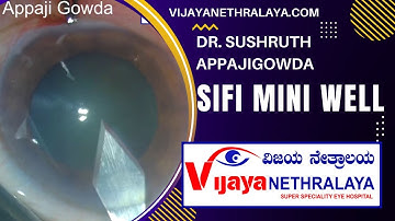 Sifi Mini Well Ready Progressive extended Depth of focus Intra Ocular Lens - Vijaya Nethralaya
