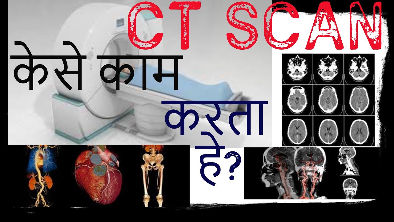 CT Scan Kaise Kiya Jata Hai !!HINDI! CT स्कॅन केसे करते हे !!basic