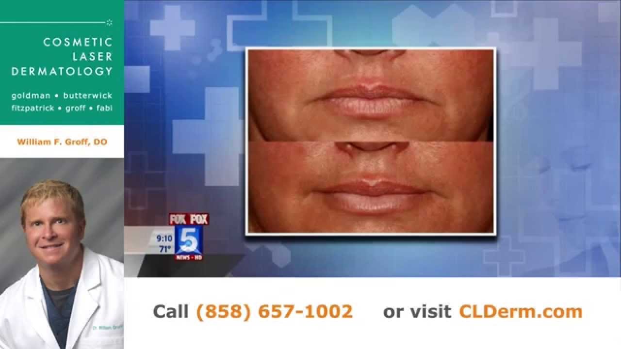 Banner for Ask the Derm: Dr. Groff Discusses Lasers, Skin Cancer, Brown Spots, and Fillers