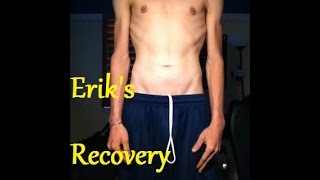 Anorexia Recovery  (The Beginning) | ErikTheElectric