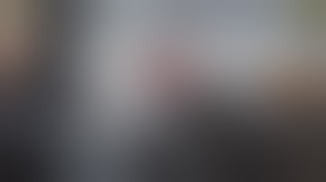 Dandruff Shampoo and Scratching, Itchy Dry Scalp, Huge Flake - Psoriasis #81