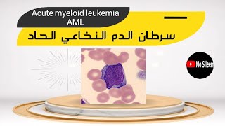 سرطان الدم النخاعي الحاد Acute myeloid leukemia 💔 AML