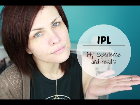 IPL For Acne Scars |My Experience + Before and After|