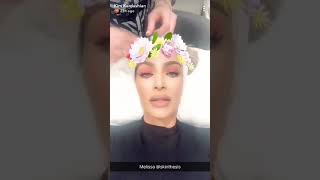 Kim kardashian lazer facial/oxygen ...