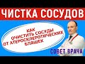 Чистка сосудов. Как снизить холестерин и очистить сосуды от атеросклеротических бляшек.