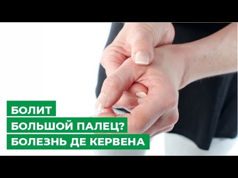 Болит большой палец? Болезнь Де Кервена