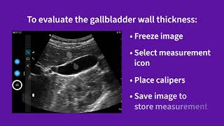 Vscan Air™ | Using presets for evaluations: gallbladder