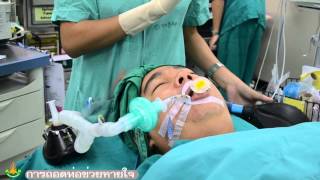 ET tube intubation - Extubation - 7. Removing the endotracheal tube.