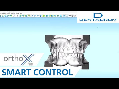 orthoX® file - SmartControl