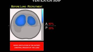 ENLIGHT 1800 VENTILATION MAPS
