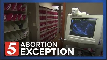 Right to Life group OKs abortion exception for mother
