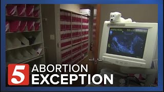 Right to Life group OKs abortion exception for mother's life