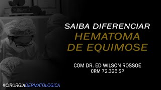 SAIBA DIFERENCIAR HEMATOMA DE EQUIMOSE | DR ED WILSON ROSSOE | CIRURGIA DERMATOLÓGICA