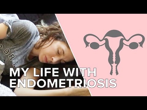 Videó: Endometriosis Life Hacks