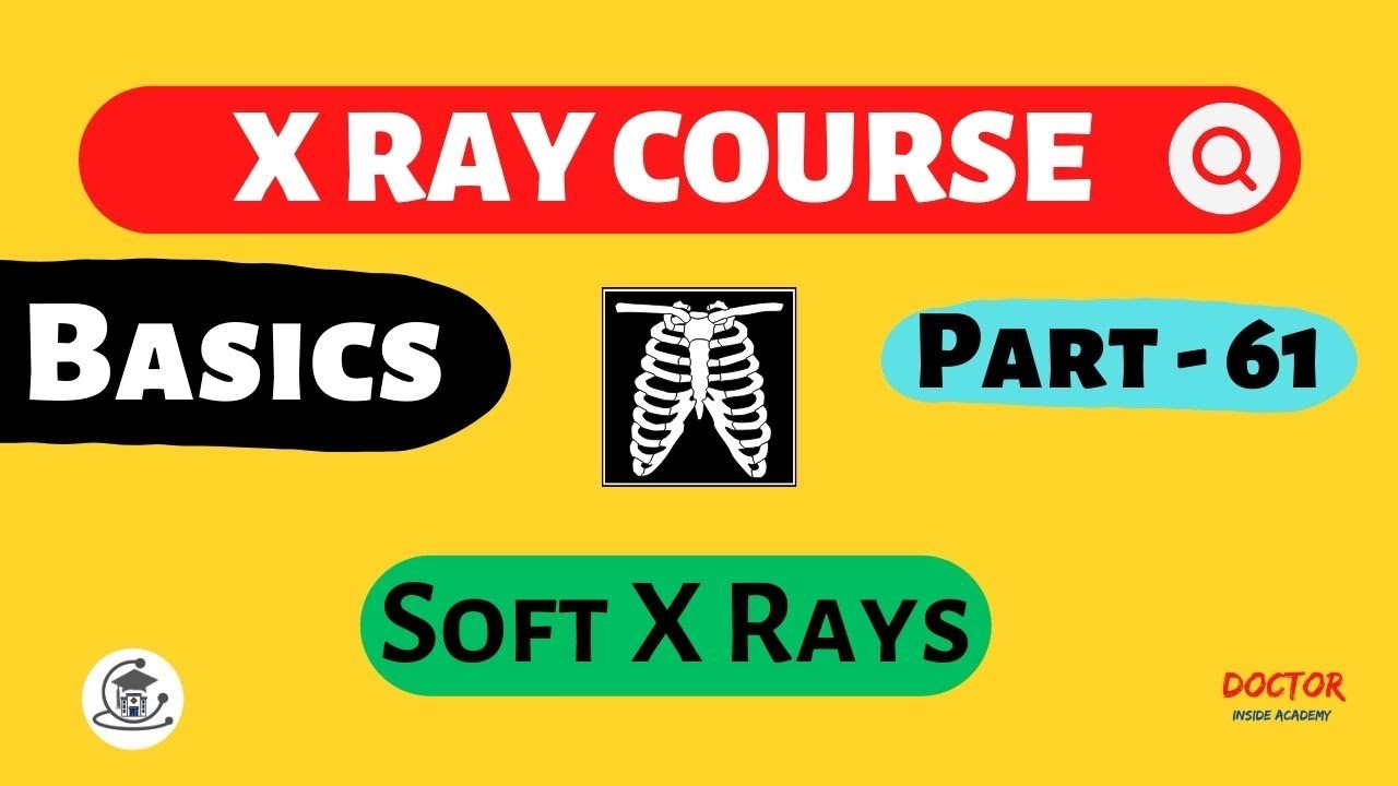 Soft X Rays | Part - 61 | X Ray Course | Doctor Inside Academy - YouTube
