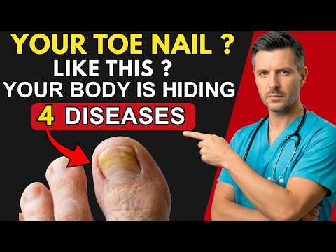 Toes Warning: If Your Toe NAILS Look Like THIS After 60, Your Body Can be Hiding 4 Diseases.