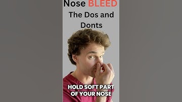 How to Stop a Nosebleed (the RIGHT Way)
